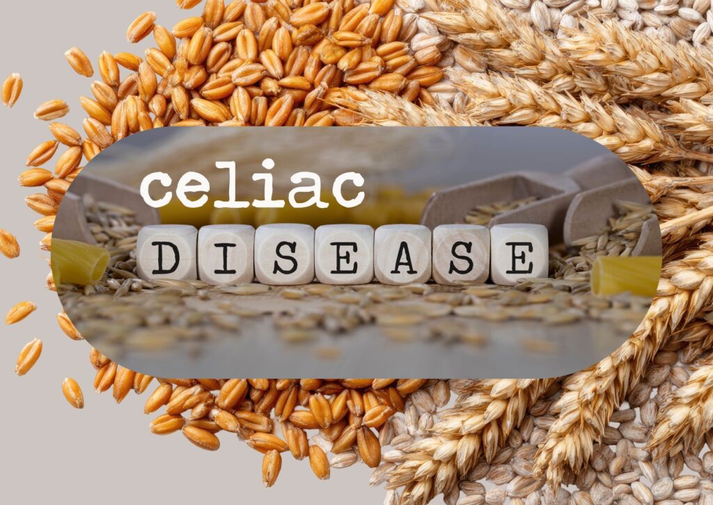 newly diagnosed celiac
